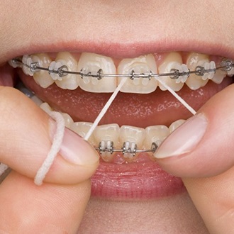 Patient flossing braces to prevent orthodontic emergencies in Marlborough 