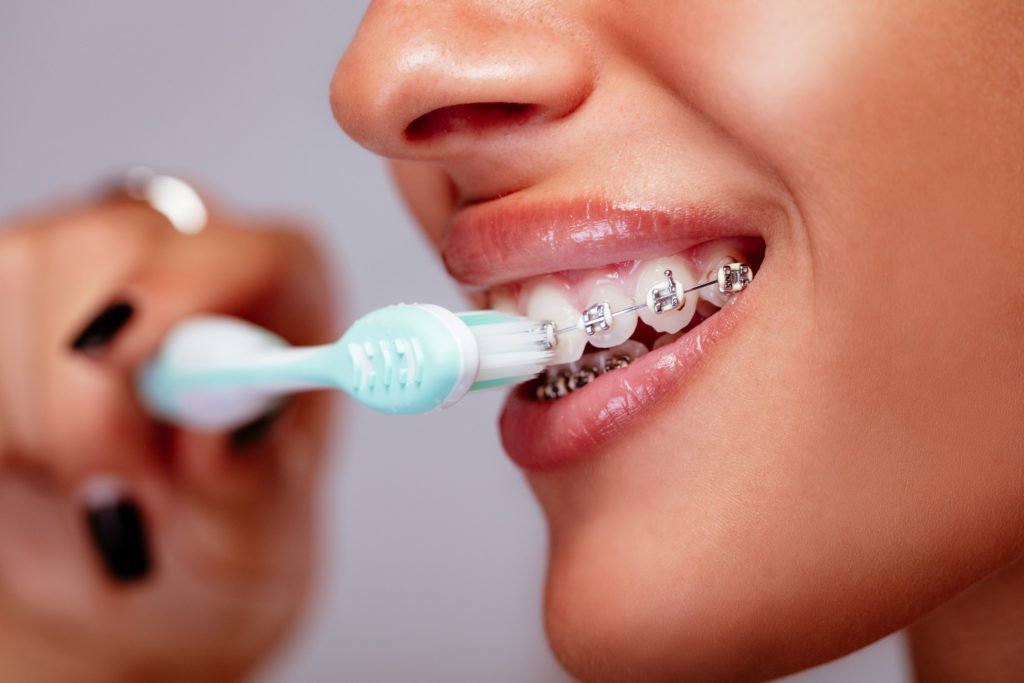 Closeup of patient with braces brushing their teeth